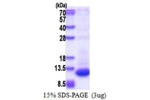 DPH3, KTI11 Homolog (S. Cerevisiae) Pseudogene 1 (DPH3P1) (AA 1-78) protein (His tag)