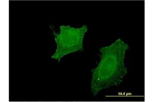 Immunofluorescence of monoclonal antibody to CNP on HeLa cell. (Cnpase Antikörper  (AA 1-421))
