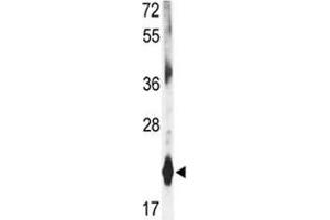 Western blot analysis of DHFR antibody and mouse liver tissue lysate