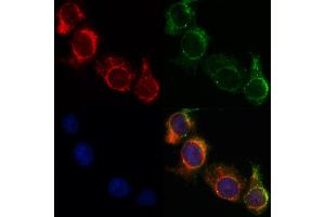 ABIN6263559 and ABIN6268825 staining HepG2 by IF/ICC.