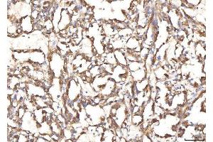 IHC analysis of BHMT using anti-BHMT antibody (ABIN7599940). (BHMT Antikörper  (AA 13-386))