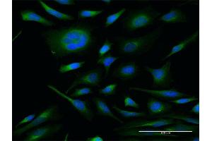 Immunofluorescence of monoclonal antibody to IL13 on HeLa cell.