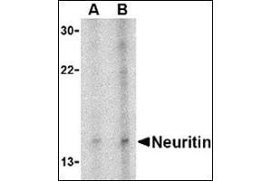 Western blot analysis of neuritin in Daudi cell lysate with this product at (A) 5 and (B) 10 μg/ml.
