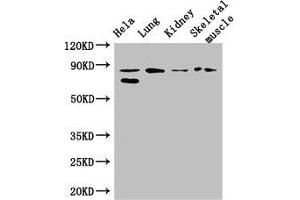 Western Blot Positive WB detected in: Hela whole cell lysate, Mouse lung tissue, Mouse kidney tissue, Mouse skeletal muscle tissue All lanes: PRDM4 antibody at 3. (PRDM4 Antikörper  (AA 301-500))