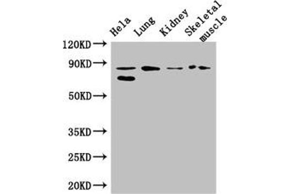 PRDM4 Antikörper  (AA 301-500)