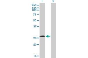 Western Blot analysis of LRRK1 expression in transfected 293T cell line by LRRK1 MaxPab polyclonal antibody. (LRRK1 Antikörper  (AA 1-261))