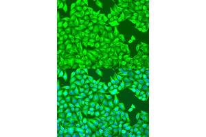 Immunofluorescence analysis of U2OS cells using TUBB8 antibody. (Tubulin, beta 8 Antikörper)