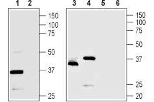 TMEM66 Antikörper  (Intracellular, Lumenal Region)