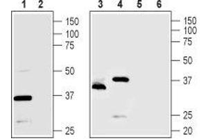 Western blot analysis of rat pancreas (lanes 1 and 2), Mouse MS1 endothelial cells (lanes 3 and 5) and human PANC1 pancreatic carcinoma cells (lanes 4 and 6) lysates: - 1,3,4. (TMEM66 Antikörper  (Intracellular, Lumenal Region))