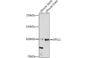 Western blot analysis of extracts of various cell lines, using VPS11 Rabbit mAb (ABIN7271272) at 1:1000 dilution.