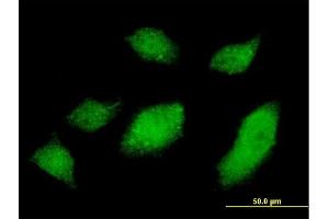 Immunofluorescence of monoclonal antibody to UBQLN1 on HeLa cell. (Ubiquilin 1 Antikörper  (AA 1-589))