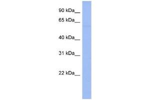 WB Suggested Anti-DTX1 Antibody Titration:  0. (Deltex Homolog 1 Antikörper  (N-Term))