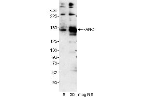 anti-Fanconi Anemia Complementation Group I (FANCI) (AA 200-250) antibody