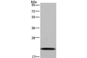 Western Blot analysis of Raji cell using NDUFAF4 Polyclonal Antibody at dilution of 1:300 (NDUFAF4 Antikörper)