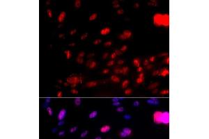 Immunofluorescence analysis of U2OS cells using Phospho-CHEK1(S317) Polyclonal Antibody (CHEK1 Antikörper  (pSer317))