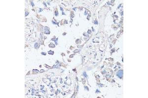Immunohistochemistry (Paraffin-embedded Sections) (IHC (p)) image for anti-Mechanistic Target of Rapamycin (serine/threonine Kinase) (mTOR) (AA 2400-2500) antibody (ABIN6144170)