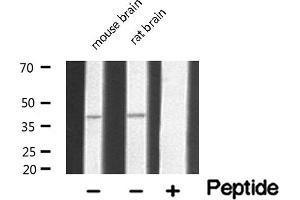 Western blot analysis of extracts of various tissue sample,using 5-HT-5A Antibody . (Serotonin Receptor 5A Antikörper  (Internal Region))