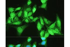 Immunofluorescence analysis of U2OS cells using KDM7A Polyclonal Antibody at dilution of 1:100. (JHDM1D Antikörper)