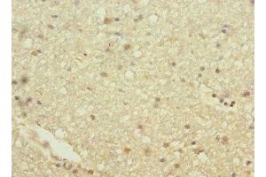Immunohistochemistry of paraffin-embedded human brain tissue using ABIN7154932 at dilution of 1:100 (HHIP Antikörper  (AA 18-220))