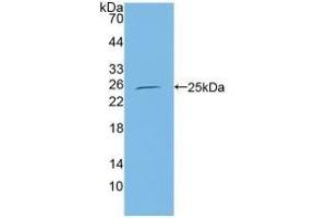 Western Blotting (WB) image for anti-Core-Binding Factor, beta Subunit (CBFB) (AA 1-182) antibody (ABIN7444154)