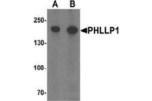 Western blot analysis of PHLPP1 in SW480 cell lysate with PHLPP1 Antibody  at (A) 1 and (B) 2 μg/ml. (PHLPP1 Antikörper  (N-Term))