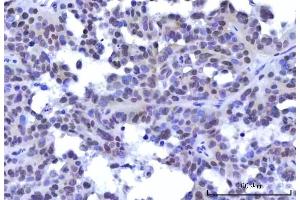 IHC analysis of RBM15B using anti-RBM15B antibody (ABIN7600219).