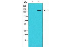 Western blot analysis on LOVO using HIF1a antibody ,The lane on the left is blocked with the antigen-specific peptide. (HIF1A Antikörper  (Internal Region))