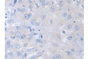 Immunohistochemistry (IHC) image for anti-Chaperonin Containing TCP1, Subunit 2 (Beta) (CCT2) (AA 1-488) antibody (ABIN7441646)