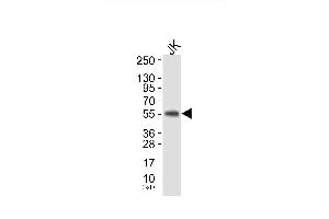 Western blot analysis of extracts from JK cells, using HS1 (Ab-397) Antibody. (HCLS1 Antikörper)