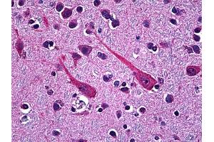 Immunohistochemistry (IHC) image for anti-Proprotein Convertase Subtilisin/kexin Type 1 (PCSK1) antibody (ABIN2471190)