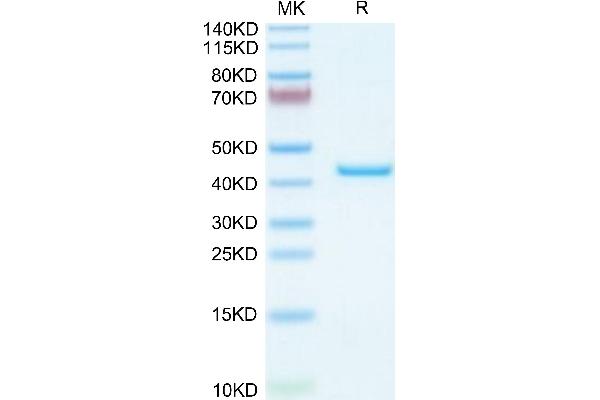 CHI3L1 Protein (AA 30-389) (His tag)