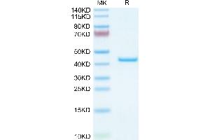 CHI3L1 Protein (AA 30-389) (His tag)