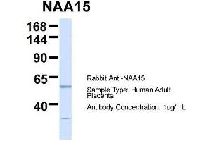 Host:  Rabbit  Target Name:  NAA15  Sample Type:  Human Adult Placenta  Antibody Dilution:  1. (NAA15 Antikörper  (N-Term))