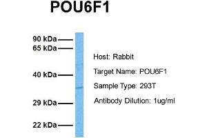 Host: Rabbit Target Name: POU6F1 Sample Tissue: Human 293T Antibody Dilution: 1. (POU6F1 Antikörper  (Middle Region))