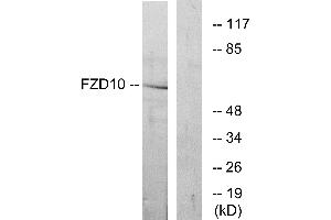Western blot analysis of extracts from COS-7 cells, using FZD10 antibody. (FZD10 Antikörper  (Internal Region))