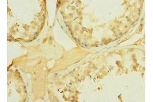 Immunohistochemistry of paraffin-embedded human testis tissue using ABIN7166559 at dilution of 1:100 (PCDH15 Antikörper  (AA 160-400))