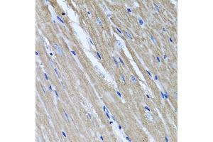Immunohistochemistry of paraffin-embedded mouse heart using TNFAIP6 antibody (ABIN5975410) at dilution of 1/100 (40x lens). (TNFAIP6 Antikörper)