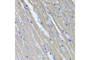 Immunohistochemistry of paraffin-embedded mouse heart using TNFAIP6 antibody (ABIN5975410) at dilution of 1/100 (40x lens).