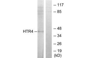 Western Blotting (WB) image for anti-Serotonin Receptor 4 (HTR4) (N-Term) antibody (ABIN1850160) (Serotonin Receptor 4 Antikörper  (N-Term))