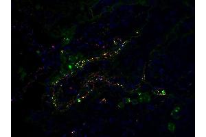 Co-expression of SARS-CoV-2 (COVID-19) Envelope and C5b-9 in Human Lung Tissue from the COVID-19 Patient: Immunofluorescent l analysis of paraffin-embedded COVID-19 patient lung tissue using anti- SARS-CoV-2 (COVID-19) Envelope antibody (ABIN1031551, 2 μg/mL, red) and anti-C5b-9 antibody (green). (SARS-CoV-2 Envelope Antikörper  (N-Term))