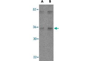 Western blot analysis of IL27 in Daudi lysate with IL27 polyclonal antibody  at (A) 2 and (B) 4 ug/mL . (IL-27 Antikörper  (Internal Region))