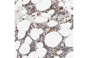 Immunohistochemical staining (Formalin-fixed paraffin-embedded sections) of human bone marrow with ZNF192 polyclonal antibody  shows strong nuclear positivity in bone marrow poietic cells. (ZNF192 Antikörper)