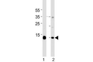 Western blot analysis of lysate from mouse 1) heart and 2) skeletal muscle tissue lysate using Myoglobin antibody at 1:1000 for each lane.