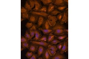 Immunofluorescence analysis of U-2 OS cells using STUB1 Polyclonal Antibody (ABIN6129459, ABIN6148649, ABIN6148650 and ABIN6215447) at dilution of 1:100 (40x lens). (STUB1 Antikörper  (AA 1-303))