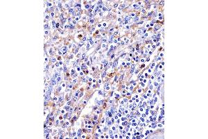 (ABIN6244292 and ABIN6578679) staining Transferrin in human spleen tissue sections by Immunohistochemistry (IHC-P - paraformaldehyde-fixed, paraffin-embedded sections). (Transferrin Antikörper  (AA 432-466))