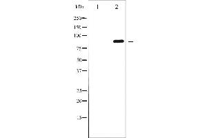 Western blot analysis of GluR2 phosphorylation expression in Mouse brain tissue lysates,The lane on the left is treated with the antigen-specific peptide. (GRIA2 Antikörper  (pSer880))