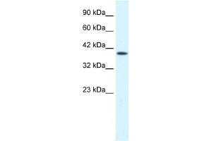 Western Blotting (WB) image for anti-Purinergic Receptor P2X, Ligand Gated Ion Channel 2 (P2RX2) (Middle Region) antibody (ABIN2776215)