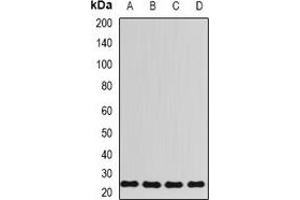 Western blot analysis of RPL13 expression in HT29 (A), Hela (B), mouse spleen (C), rat lung (D) whole cell lysates. (RPL13 Antikörper)