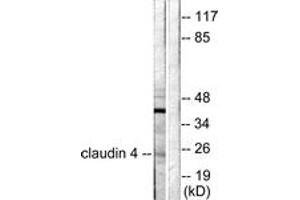 Western blot analysis of extracts from HeLa cells, using Claudin 4 Antibody. (Claudin 4 Antikörper  (AA 160-209))