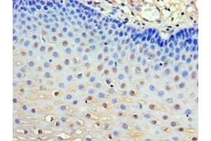 Immunohistochemistry of paraffin-embedded human esophagus tissue using ABIN7154506 at dilution of 1:100
